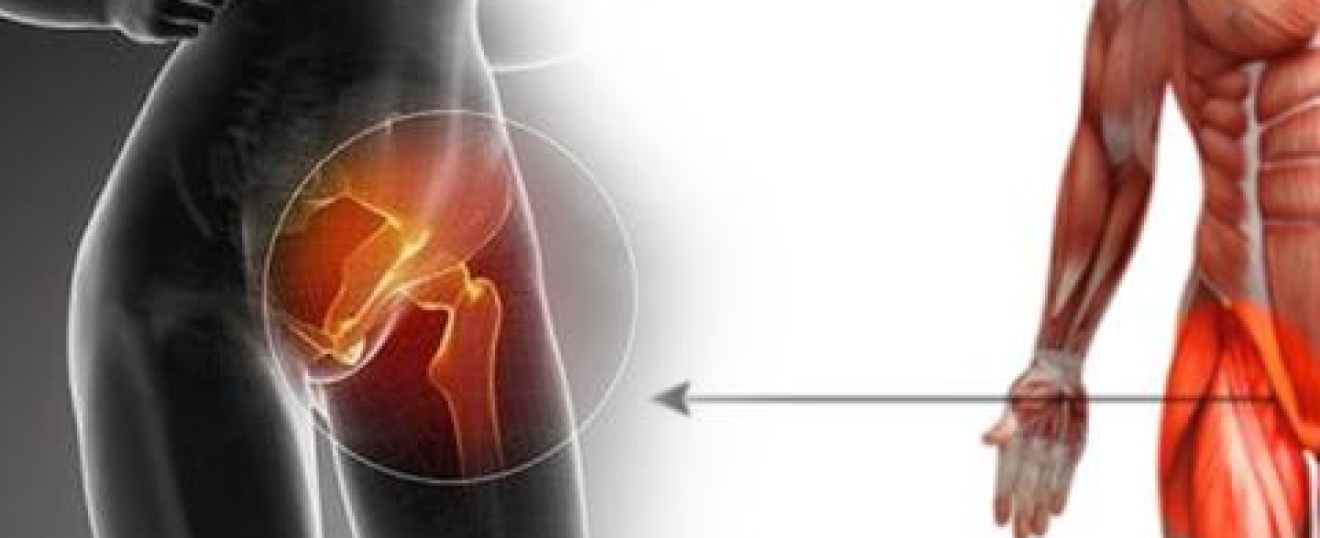 Osteitis Pubis