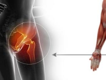 Osteitis Pubis