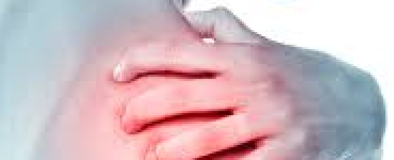 Adhesive Capsulitis (Frozen shoulder)