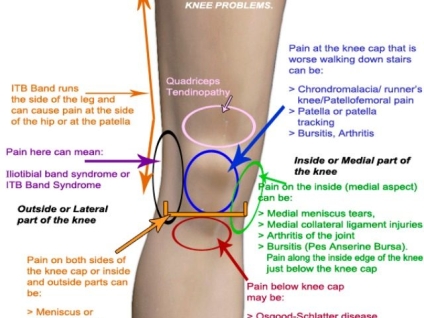 Knee Pain