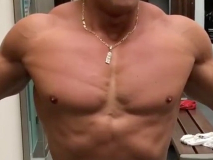 Rippling Muscle Disease