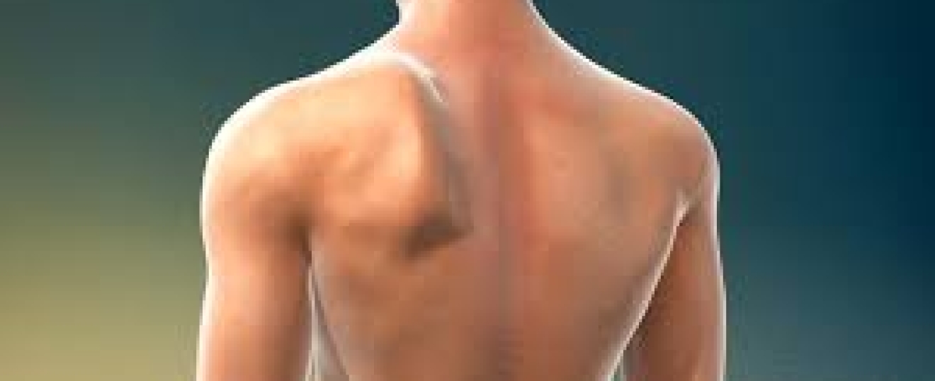 Winged Scapula
