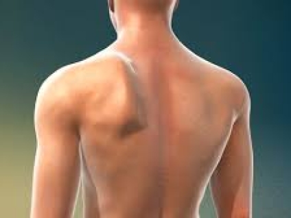 Winged Scapula