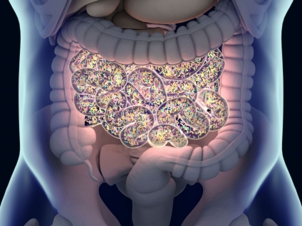 Small Intestinal Bacterial Overgrowth