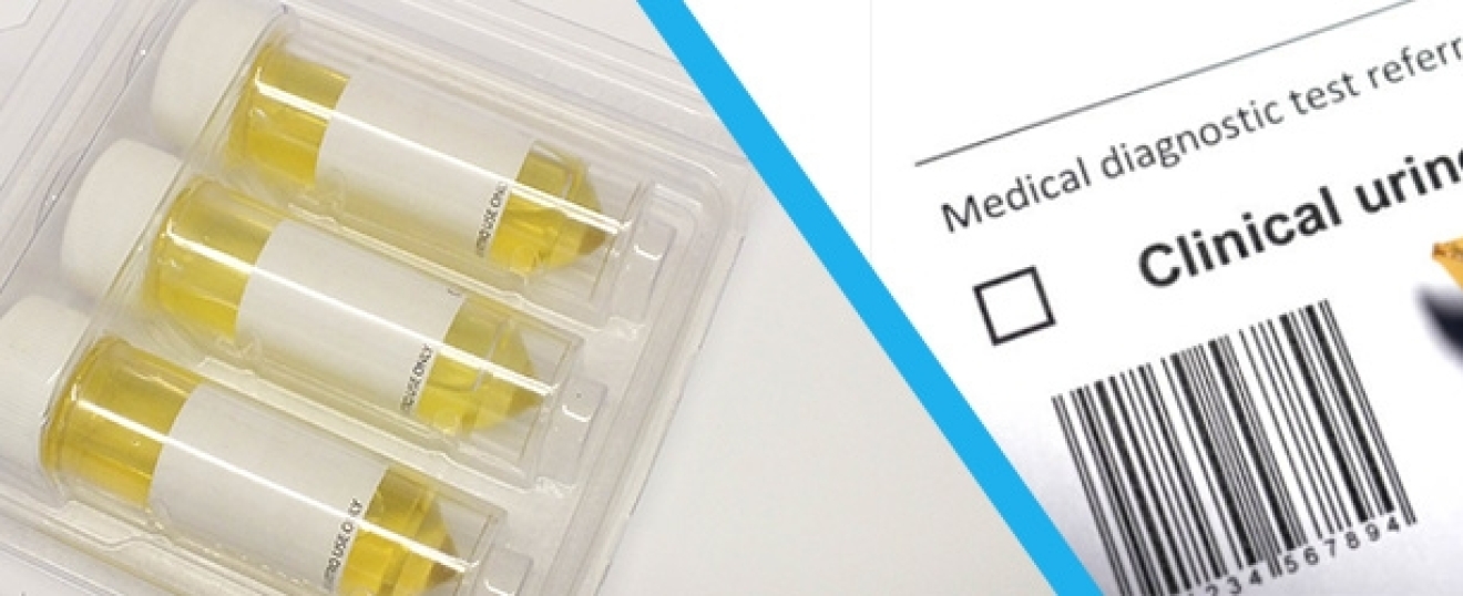 What Does the Colour of Your Urine Mean