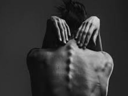 Massage for Eating Disorders