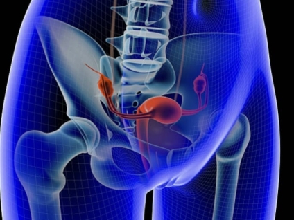 Massage for Endometriosis