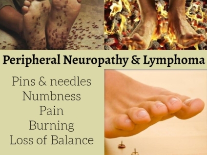 Peripheral Neuropathy