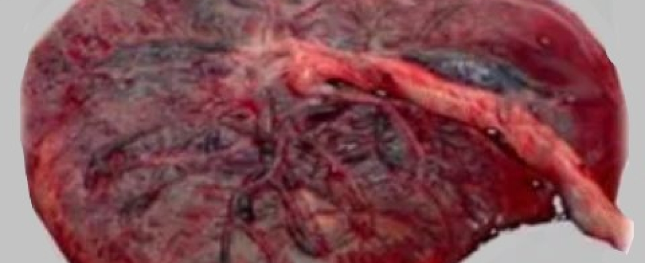 The Effect of Massage on the Placenta