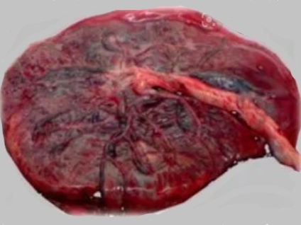 The Effect of Massage on the Placenta