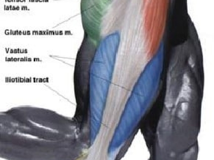 Gluteus Medius Syndrome (Runners Butt)