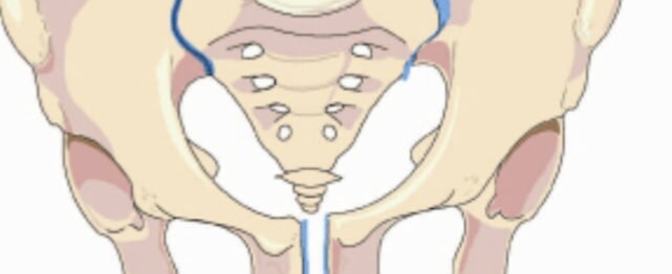 Massage for Symphysis Pubis Dysfunction