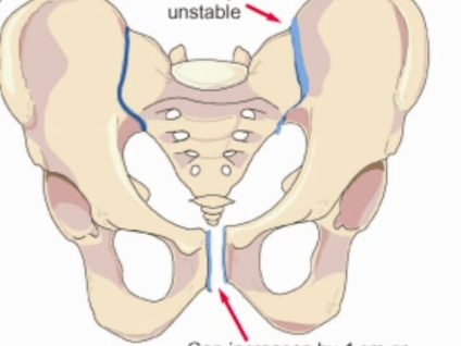 Massage for Symphysis Pubis Dysfunction