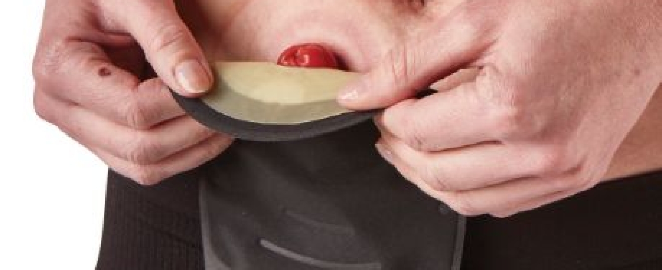 Massage for the Client with a Stoma