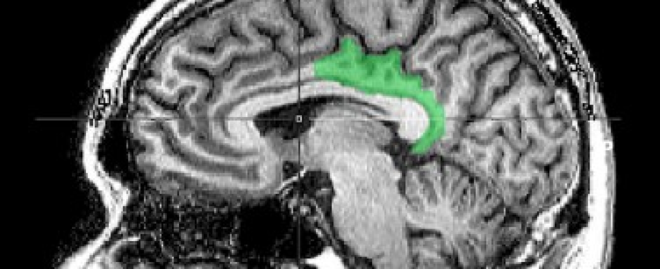 How Trauma Impacts Our Memories