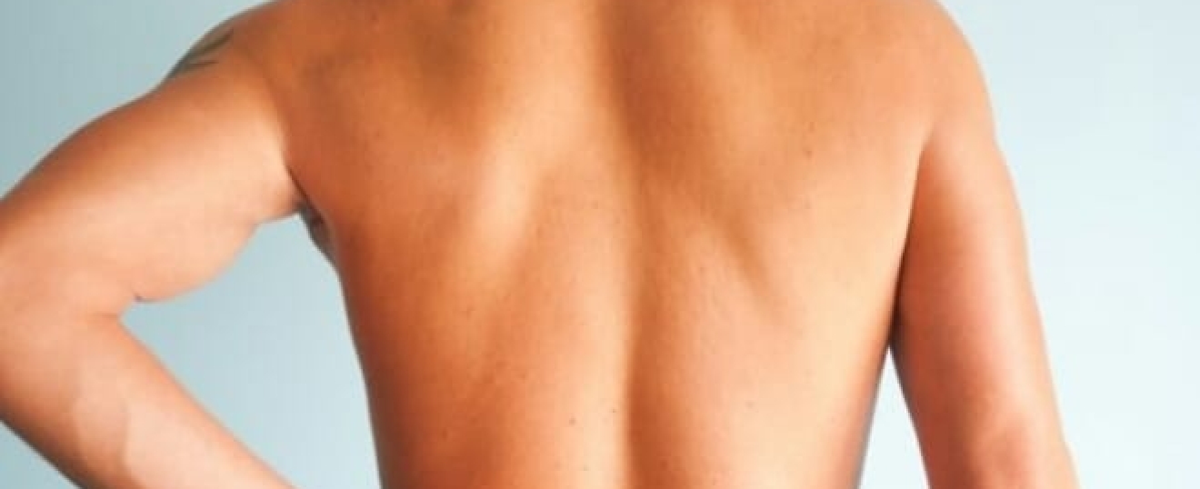 Why Your Back Isn't Always the Cause of Your Back Pain