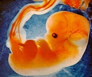 FOETUS