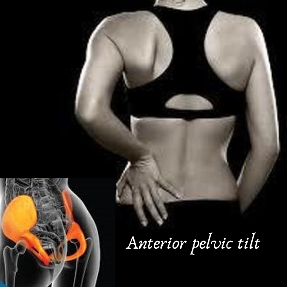 antpelvictilt