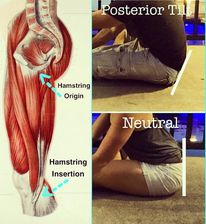 causeofbackpain3