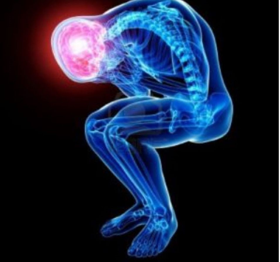 chronicpain52