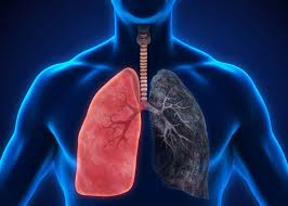 copd