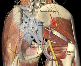 deepglutealsyndrome2