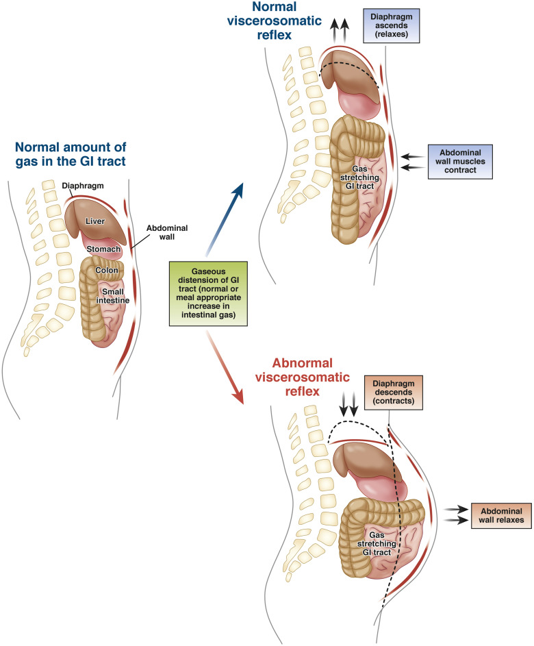 diaphragm7