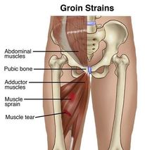 groin3