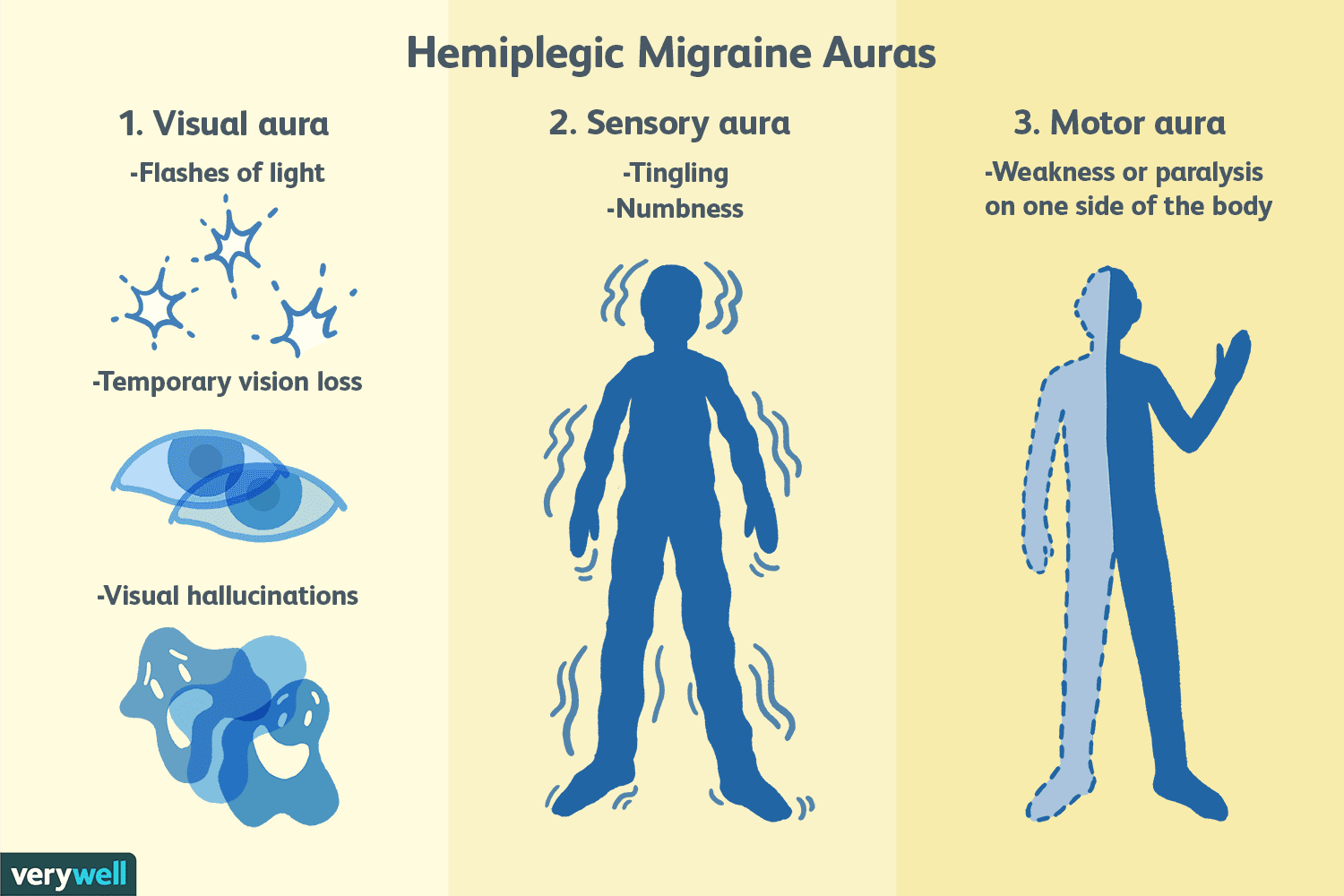 hemiplegicmigraine2