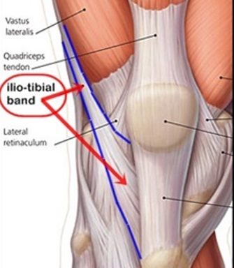 itband4