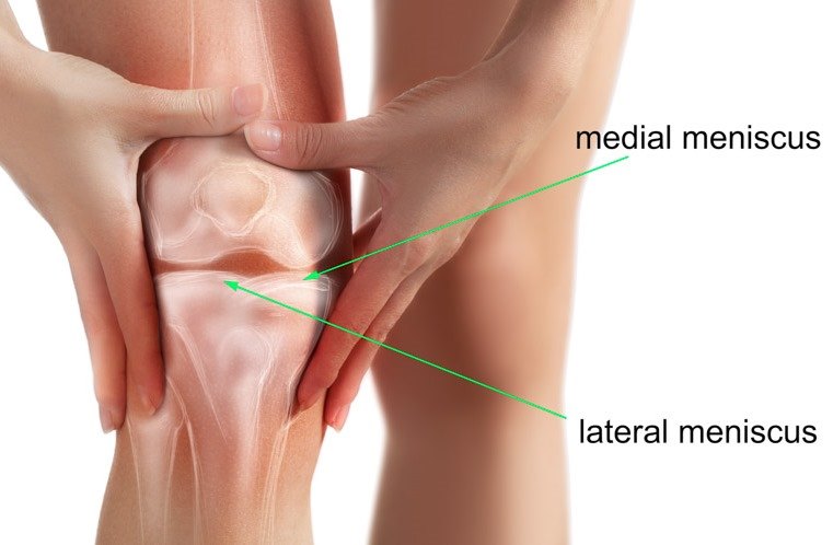 meniscus5