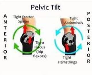 pelvictilt3
