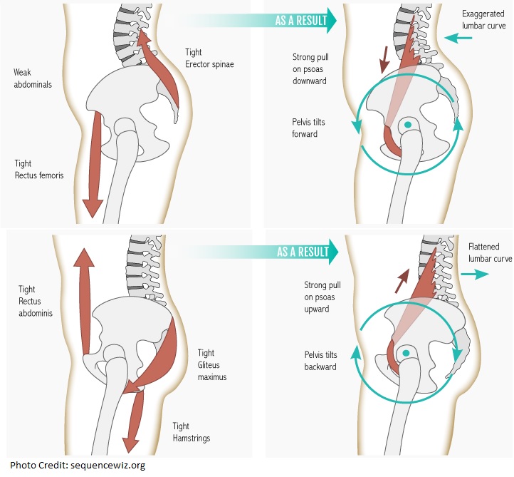 pelvictiltmuscles