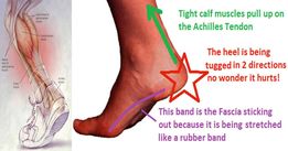 plantarf1