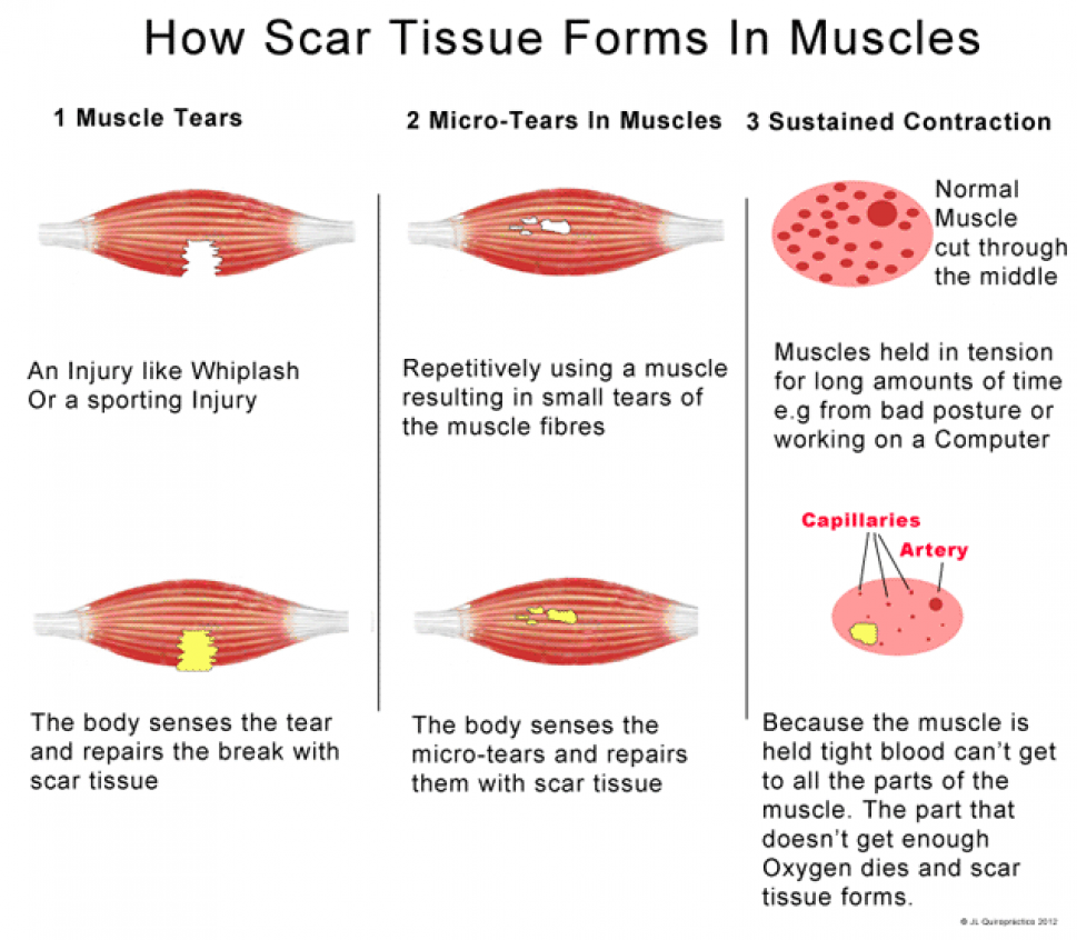 scars2
