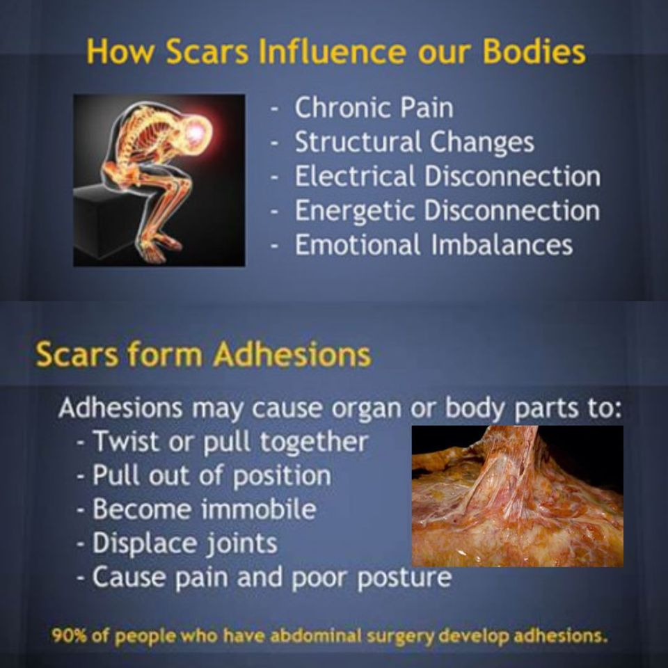 scars3
