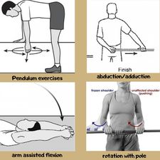 shdislocation12