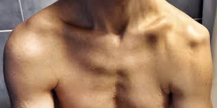 shdislocation4