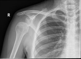 shdislocation6inf