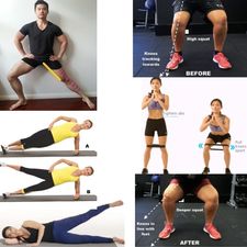 valgus6